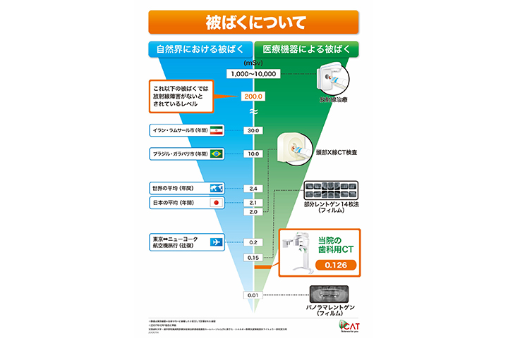 被ばくについて